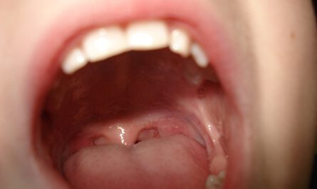 Das orale Mikrobiom: wir haben auch im Mund Bakterien